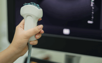 Why You Need an Ultrasound Before Abortion